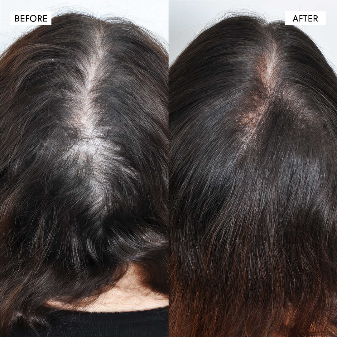 Hair Growth Serum