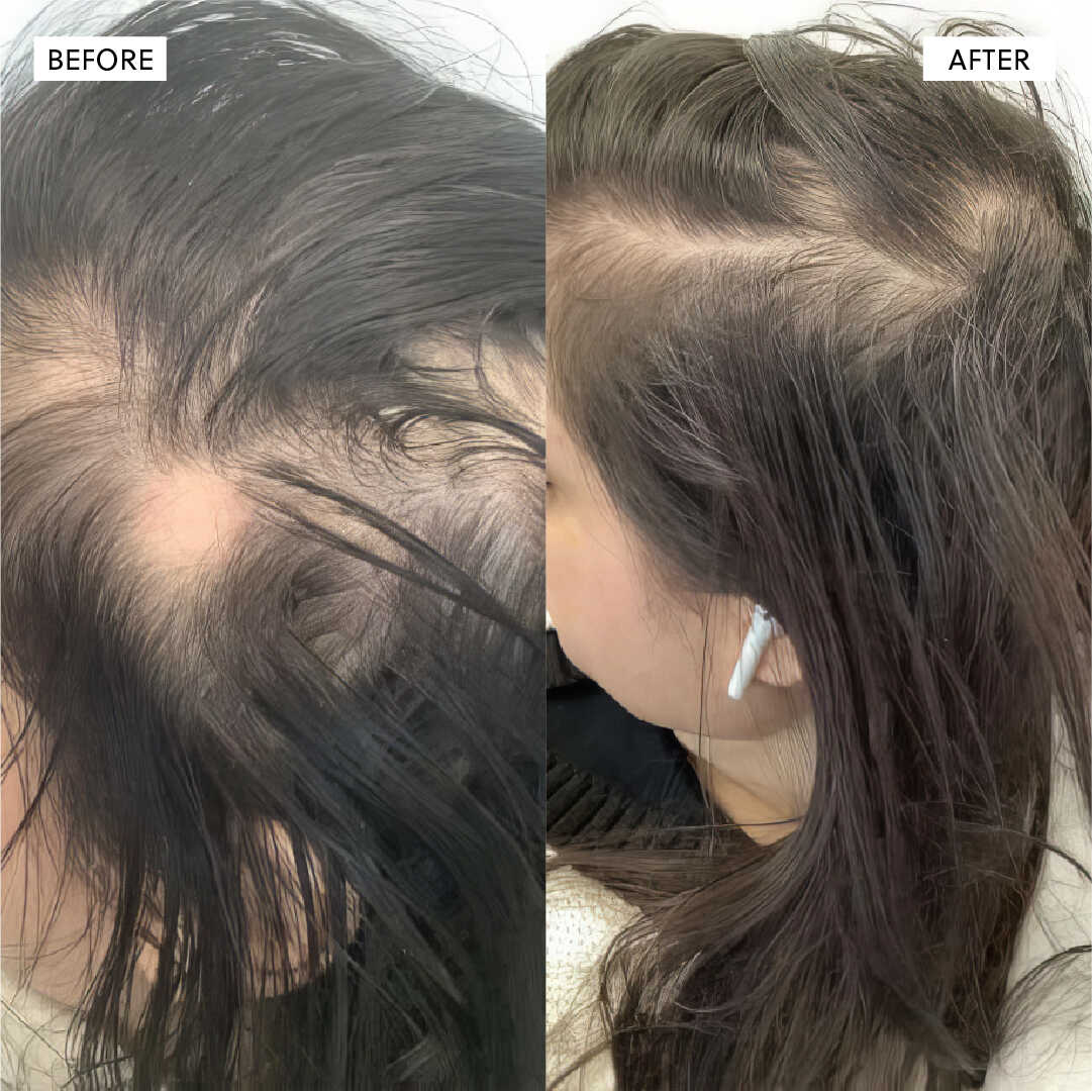 Hair Growth Serum