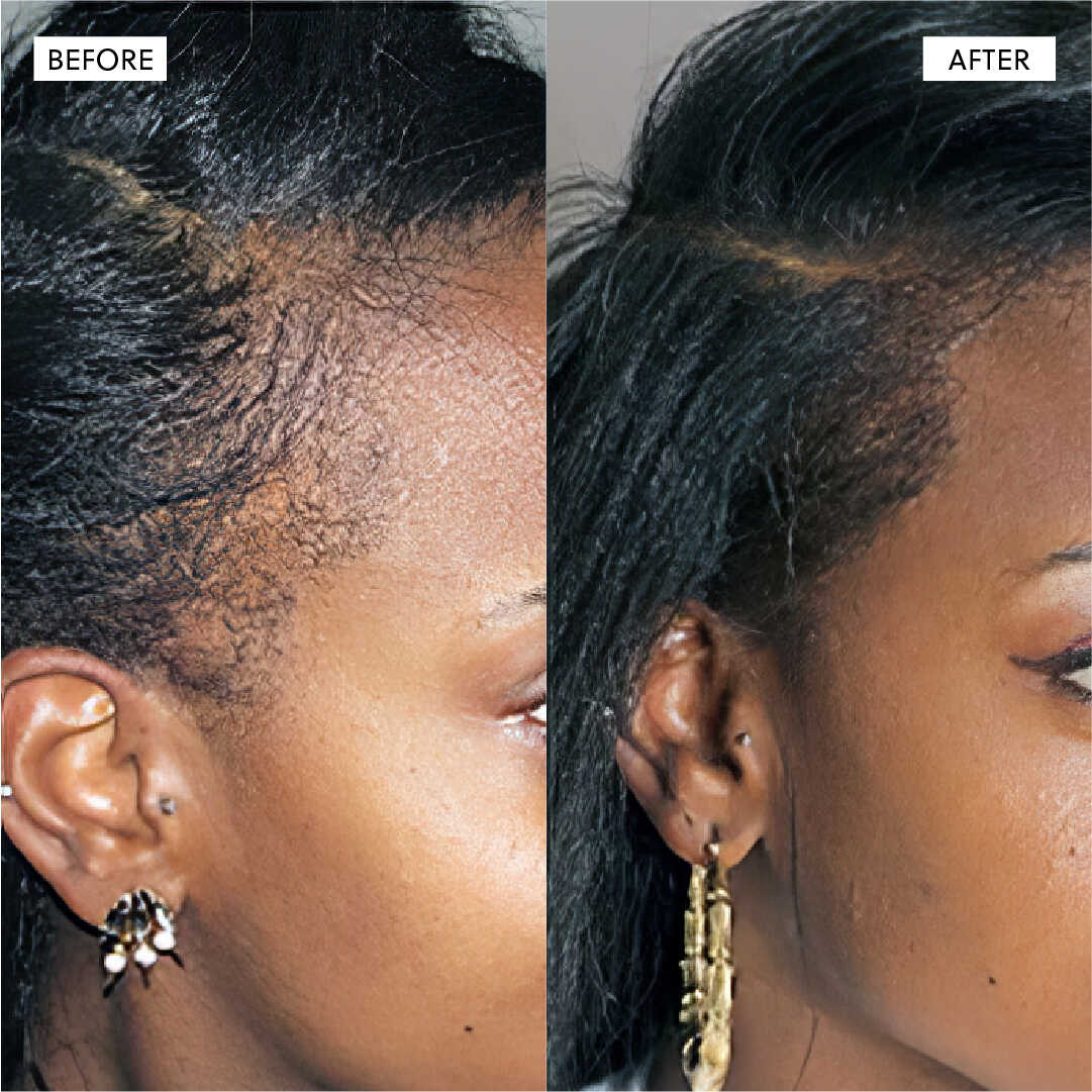 Hair Growth Serum